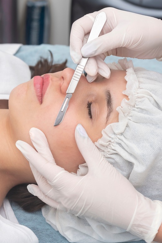 DERMAPLANING